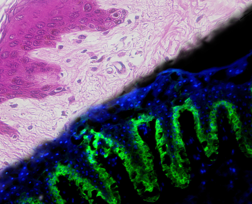 Preclinical Tests